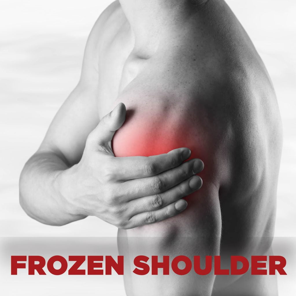 condition 01 frozenshoulder