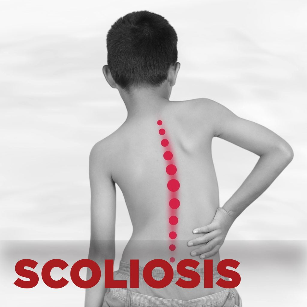 condition 01 scoliosis