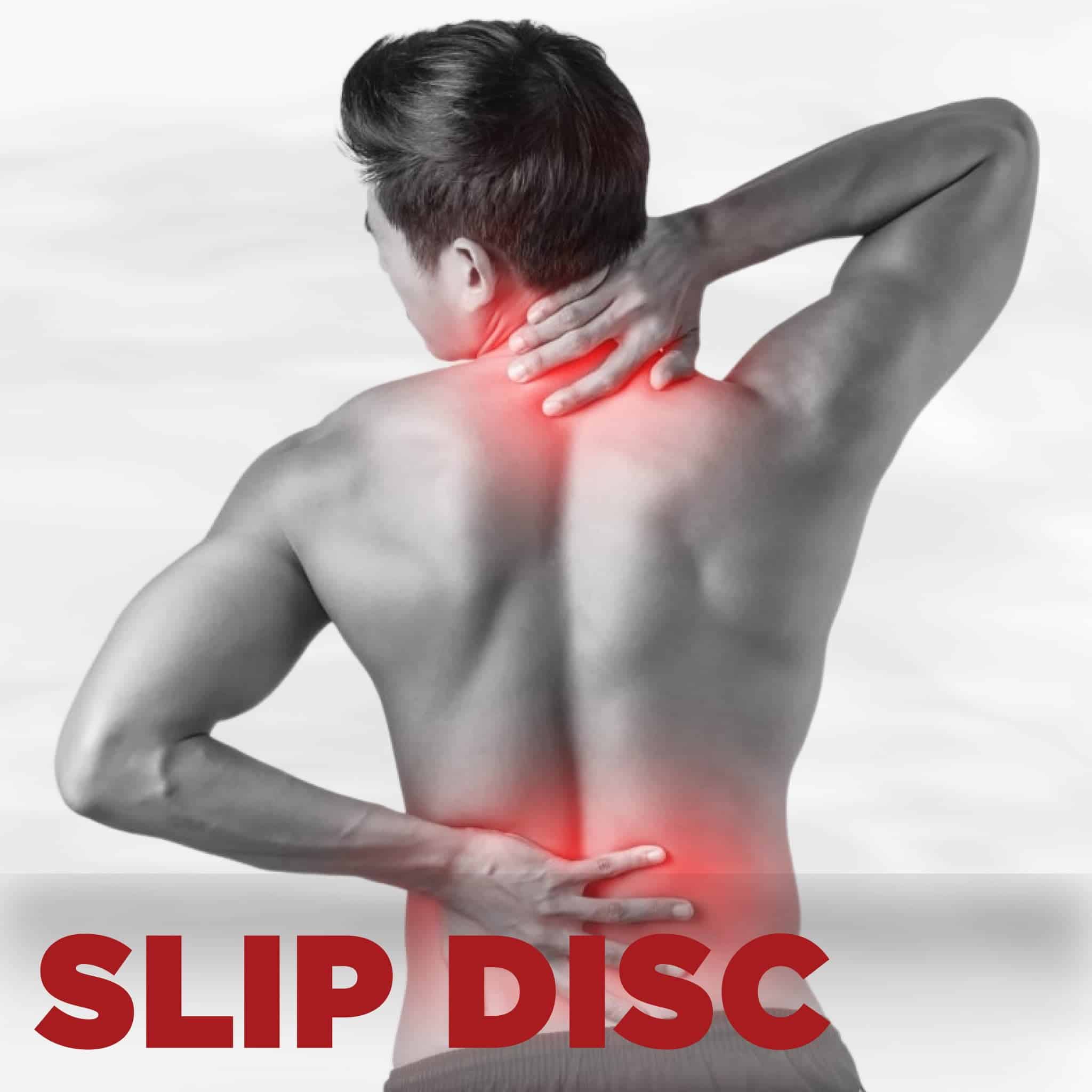 [2026] Slipped Disc | How physiotherapy help!