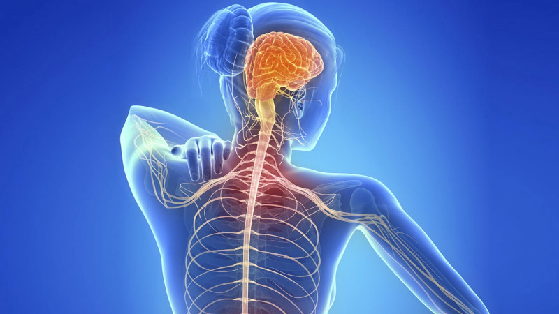 Educational illustration representing multiple sclerosis and the central nervous system