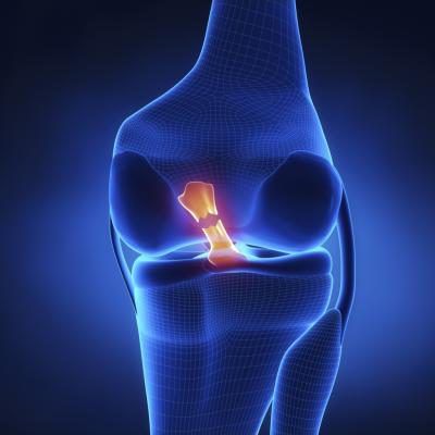 ACL SPORTS - kecederaan ligamen ACL lutut