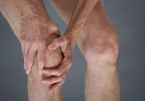Osteoarthritis Physiotherapy
