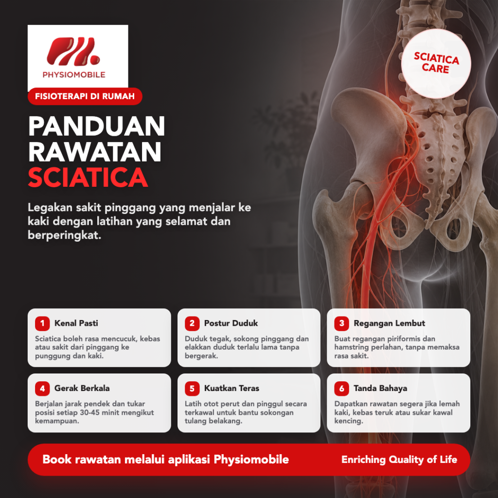 sciatica square infographic