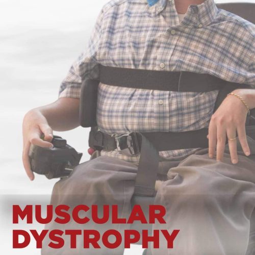 muscular dystrophy treatment