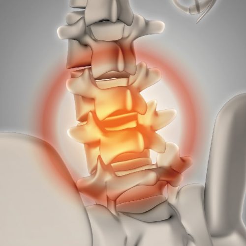 skeleton-3d-pain square-02-01