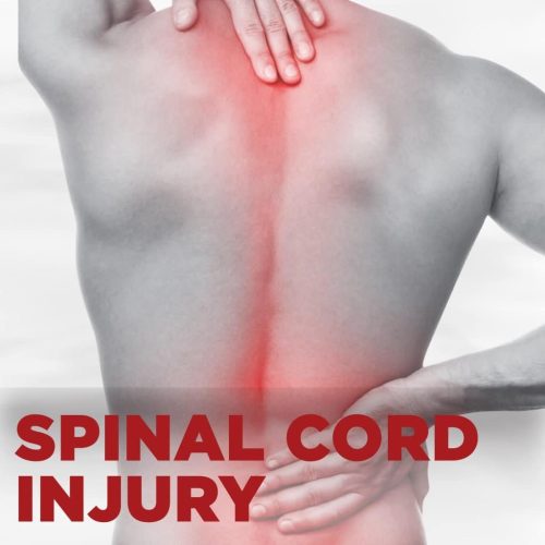 spinal cord injury