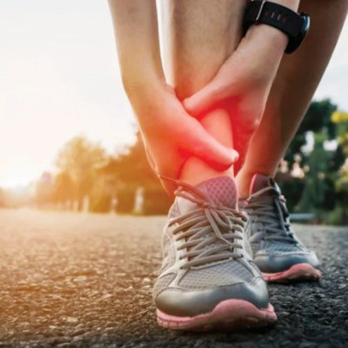 kaki terseliuh dan bengkak